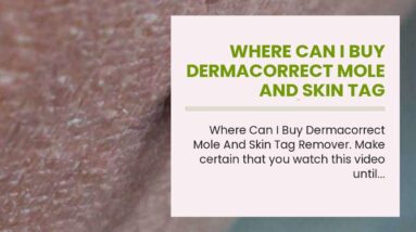 Where Can I Buy Dermacorrect Mole And Skin Tag Remover (EXPOSED: Is It WORTH It?!)