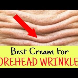 Best Cream For Forehead Wrinkles (Watch!)