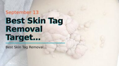 Best Skin Tag Removal Target (UPDATE: Does It Work?!)