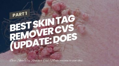 Best Skin Tag Remover Cvs (UPDATE: Does It Work?!)