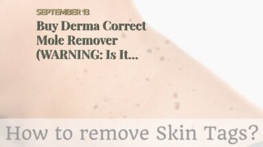 Buy Derma Correct Mole Remover (WARNING: Is It LEGIT?!)