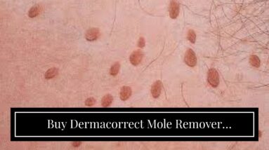 Buy Dermacorrect Mole Remover (WARNING: What You Should Know!)