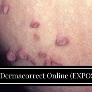 Buy Dermacorrect Online (EXPOSED: Truth About Skin Tags!)