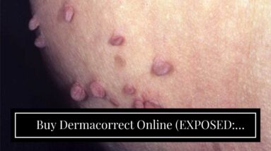 Buy Dermacorrect Online (EXPOSED: Truth About Skin Tags!)