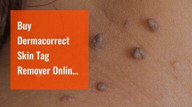 Buy Dermacorrect Skin Tag Remover Online (MUST SEE: Breakthrough!)