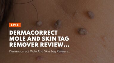 Dermacorrect Mole And Skin Tag Remover Reviews (EXPOSED: What You Should Know!)