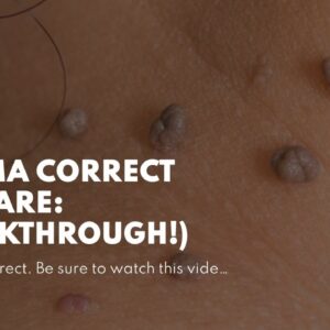Derma Correct (BEWARE: Breakthrough!)
