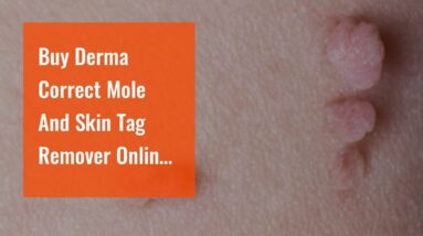 Buy Derma Correct Mole And Skin Tag Remover Online (MUST SEE: Is It WORTH It?!)
