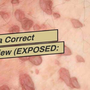 Derma Correct Review (EXPOSED: What You Should Know!)