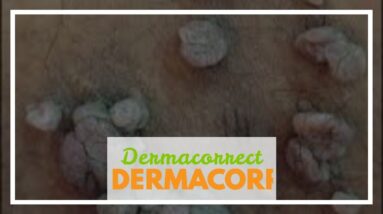 Dermacorrect Customer Reviews (WARNING: What You Should Know!)