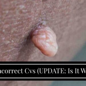 Dermacorrect Cvs (UPDATE: Is It WORTH It?!)