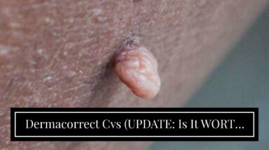 Dermacorrect Cvs (UPDATE: Is It WORTH It?!)