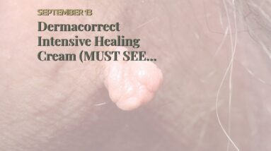 Dermacorrect Intensive Healing Cream (MUST SEE: Is It LEGIT?!)