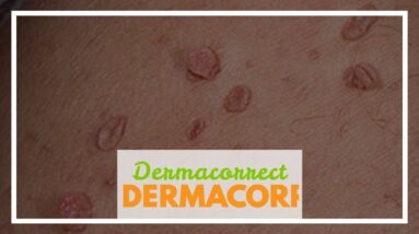 Dermacorrect Shark Tank (MUST SEE: New Breakthrough!)