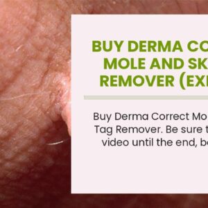 Buy Derma Correct Mole And Skin Tag Remover (EXPOSED: What They Don't Tell You!)