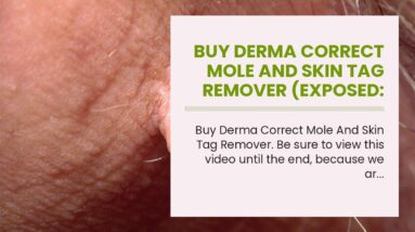Buy Derma Correct Mole And Skin Tag Remover (EXPOSED: What They Don't Tell You!)