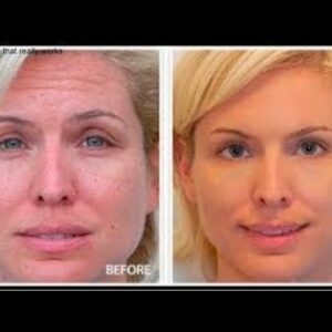 Eye Wrinkle Cream Reviews (How To Reduce Eye Wrinkles And Fine Lines)