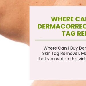 Where Can I Buy Dermacorrect Skin Tag Remover (BEWARE: What You Should Know!)