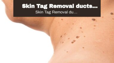 Skin Tag Removal ducts Target (UPDATE: Is It WORTH It?!)