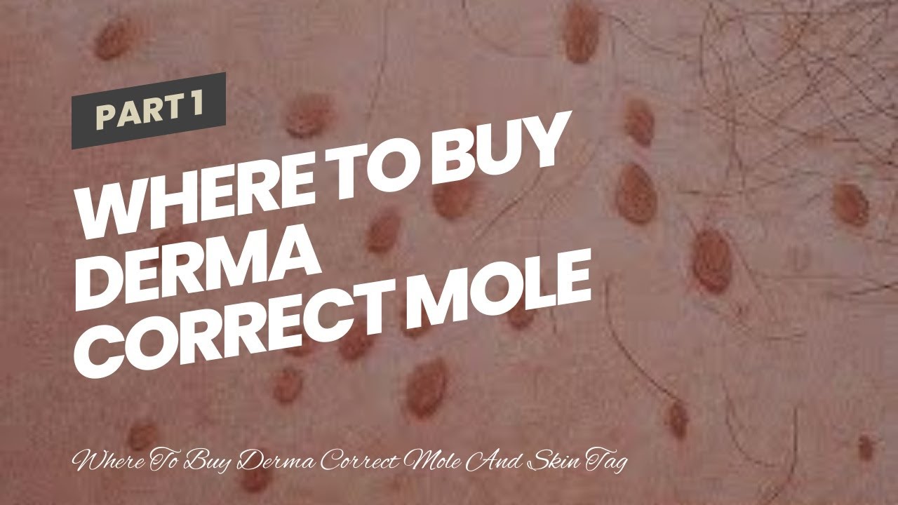 Where To Buy Derma Correct Mole And Skin Tag Remover (BEWARE: What You - Derma Rx Skin Tag Remover Reviews