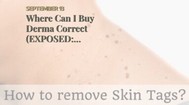 Where Can I Buy Derma Correct (EXPOSED: Breakthrough!)