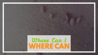 Where Can I Buy Derma Correct Skin Tag Remover (EXPOSED: Breakthrough!)