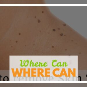 Where Can You Buy Derma Correct (EXPOSED: Does It Work?!)