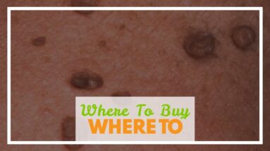 Where To Buy Derma Correct Skin Tag Remover (UPDATE: Does It Work?!)