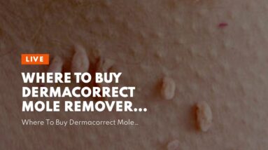 Where To Buy Dermacorrect Mole Remover (UPDATE: Is It WORTH It?!)