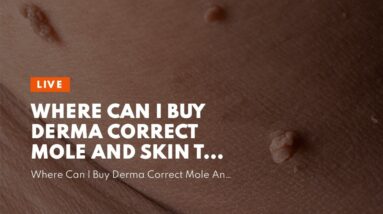 Where Can I Buy Derma Correct Mole And Skin Tag Remover (EXPOSED: What You Should Know!)